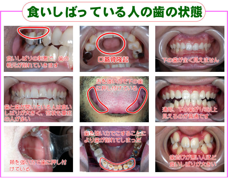 �H�����΂��Ă���l�̎��̏��