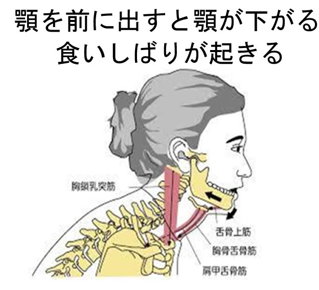 顎関節症の原因 大阪府堺市中区の西村歯科